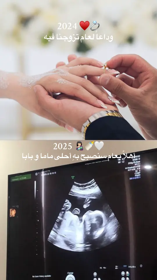 🤍🥹 #pregnant #2025 #mama #fouryou #sweden #dubai 