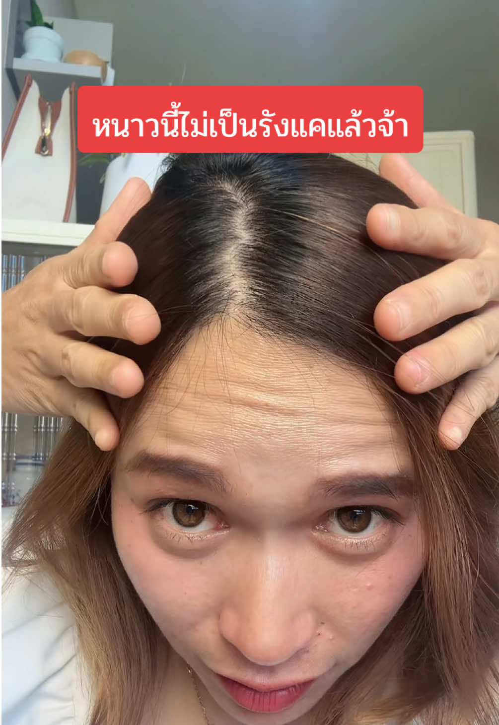 หนาวนี้ไม่เป็นรังแคแล้วจ้า #cokki #แชมพูcokki #แชมพูลดรังแค #รังแค #แชมพู #ยาสระผม #ของดีบอกต่อ #มีมี่มารีวิว🌷 