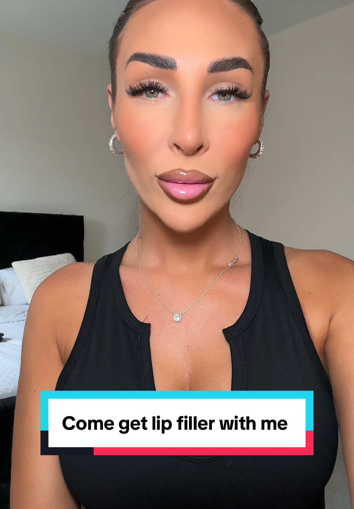 Come get lip filler with me @A-STAR AESTHETICS ACADEMY Jamie is the best for Russian lips #lipfiller #lips #biglips #overfilledlips #lipdissolving #fillerlips #ducklips #migratedlips 