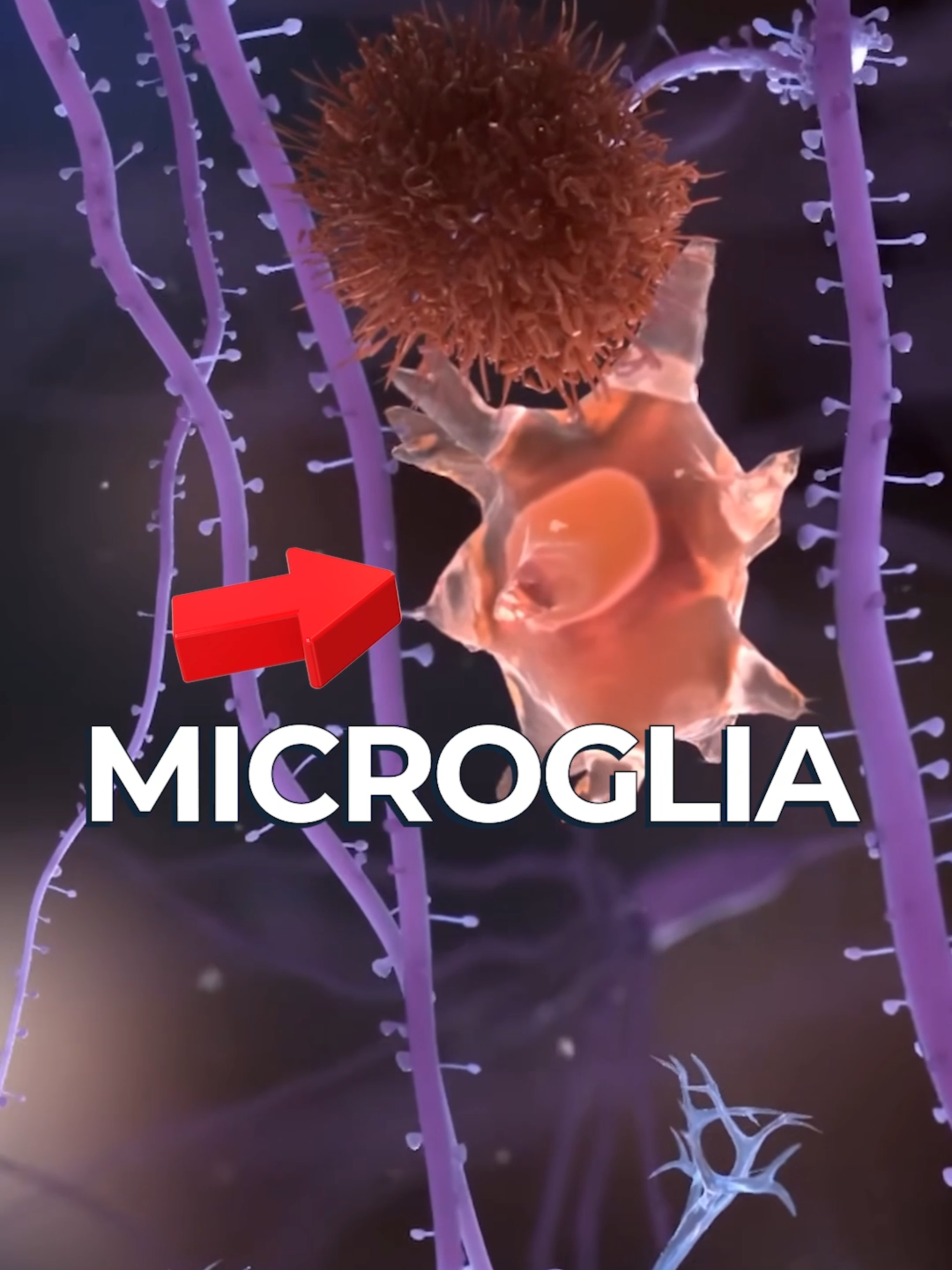 Scientists Discover Potential Cause of Alzheimer's Disease Published in Neuron, scientists have revealed a groundbreaking discovery surrounding the cause of Alzheimer's disease. The study focuses on microglia and their evil counterpart 'dark microglia' - they hope by understanding this cause of neurodegeneration they may be able to prevent it.   paper: https://www.cell.com/neuron/abstract/S0896-6273(24)00875-4?_returnURL=https%3A%2F%2[…]vier.com%2Fretrieve%2Fpii%2FS0896627324008754%3Fshowall%3Dtrue  #fyp #foryoupage #breakthrough  #medical #alzheimersdisease #science
