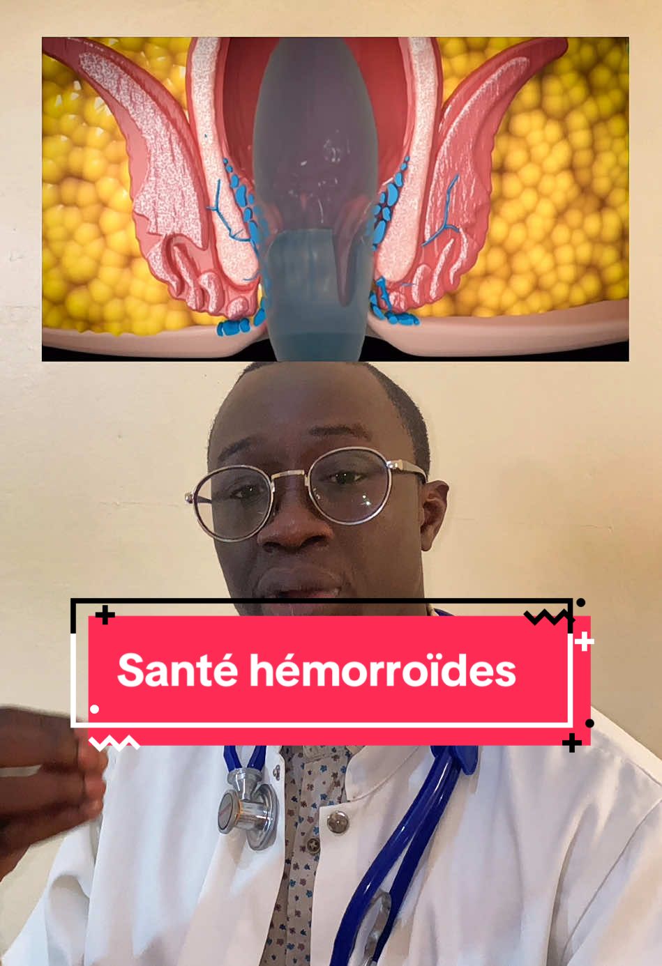 Comment soulager la maladie hémorroïdaire.                  #conseil #senegalaise_tik_tok #france #hemorroides 