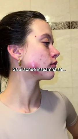 Este atat de obositor…dar sunt sigur ca vom trece peste aceste momente dureroase si grele🙏🏻❤️‍🩹 #acnepositivity #acnetreatment #acnevulgaris #acneisbeautiful #smallcreator #acneevulgara #acneechistica #acneeadolescenti #chisturi 