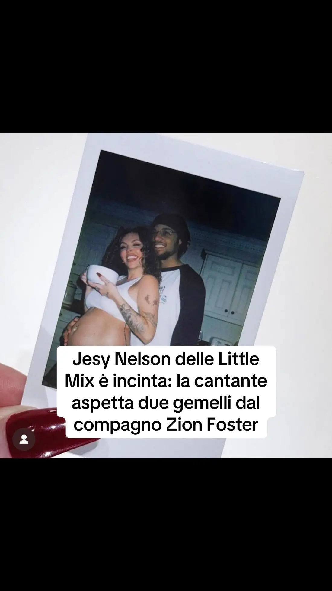 Jesy Nelson delle Little Mix è incinta: la cantante aspetta due gemelli dal compagno Zion Foster #jesynelson #littlemix #gossip 