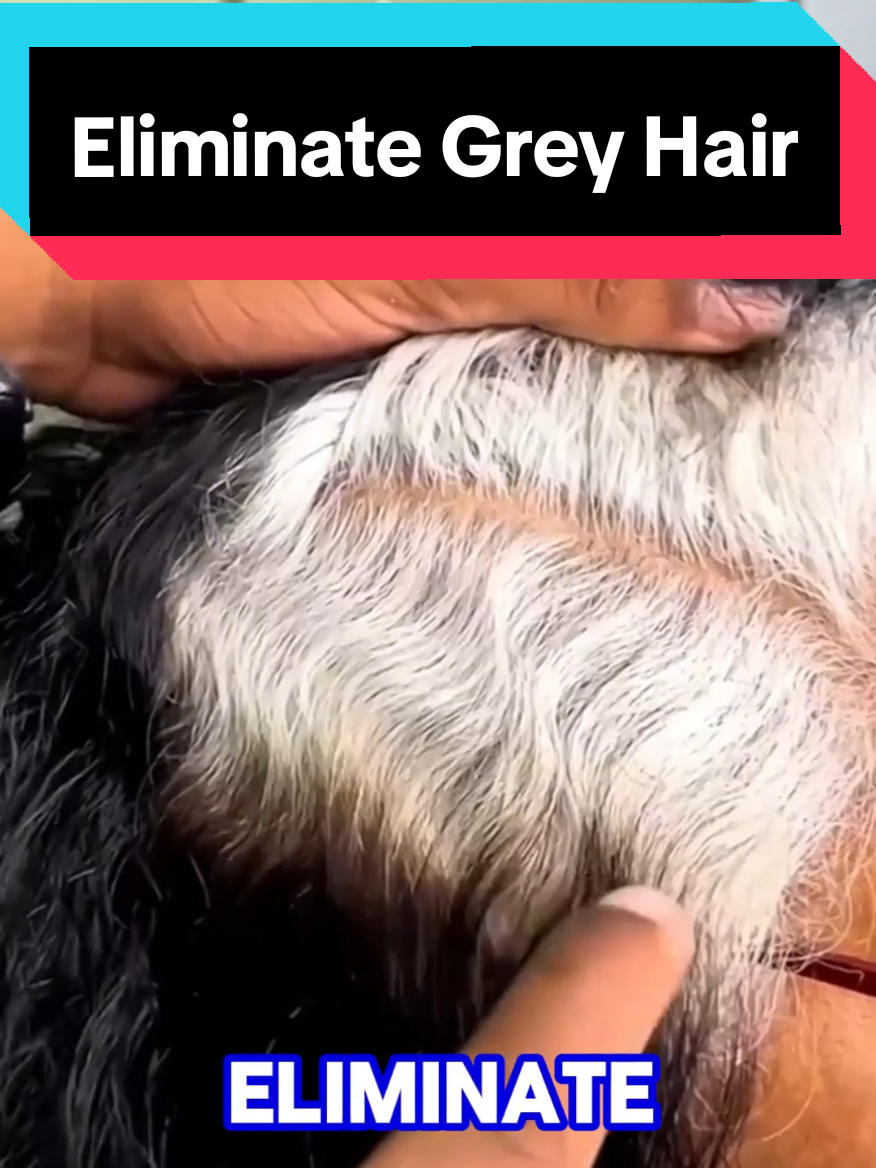 Say goodbye to white hair. It will be black again. #greyhair #grayhair #whitehair #grayhairsolution #hairgray #greyhairs  #greyhairdontcare #grayhairdontcare #whitehairdontcare  Eliminate your gray hair forever without using dyes or chemical products that damage your hair. With just two ingredients, you can get rid of all your gray hair once and for all. #recipes #Recipe #remedy #naturalremedy #naturalrecipes 