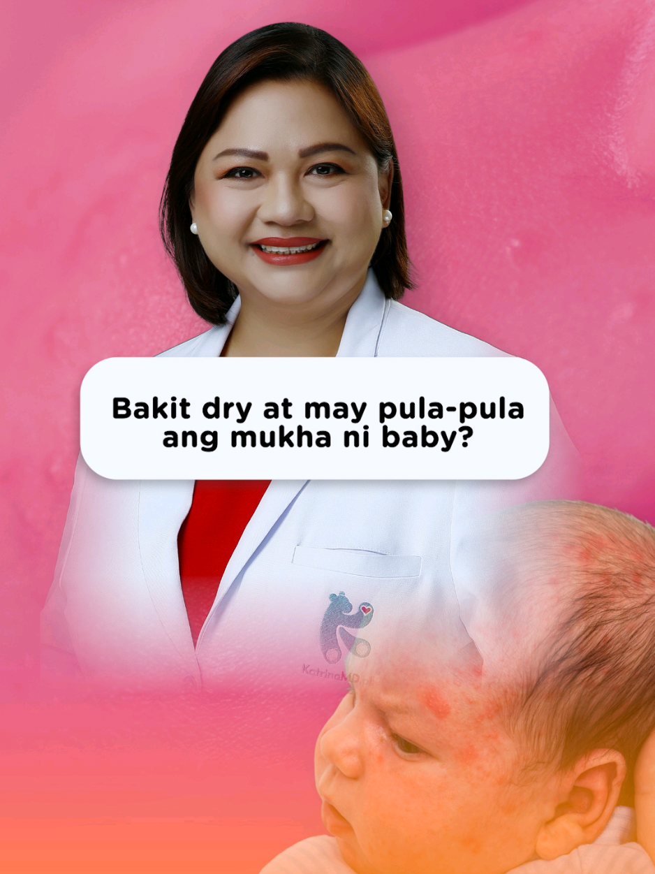 Bakit dry at may pula-pula ang mukha ni baby? Ano ang baby acne at ano dapat gawin dito? @Mama's Choice Philippines  #KatrinaMDph #OneLessWorry #MamasChoiceph