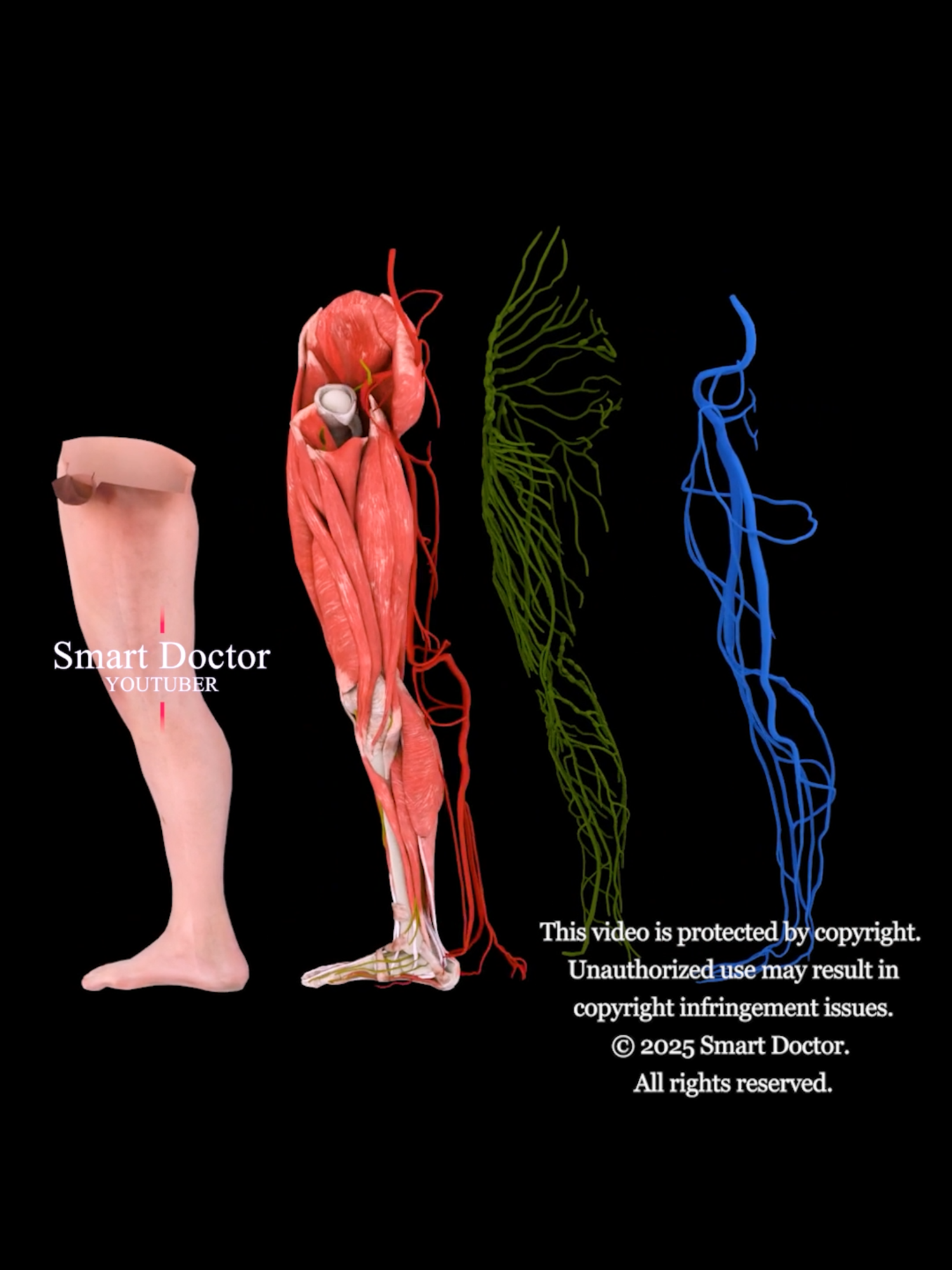 #TikTokAwards  Anatomy of the Human Leg with all its Systems ✨ . . The human leg consists of several key systems and components: Skeletal System Femur: Thigh bone, the longest in the body. Patella: Kneecap, protects the knee joint. Tibia: Shin bone, larger and weight-bearing. Fibula: Smaller bone alongside the tibia. Tarsals: Seven ankle bones. Metatarsals: Five foot bones. Phalanges: Toe bones. Muscular System Quadriceps: Four muscles extending the knee. Hamstrings: Three muscles flexing the knee. Gastrocnemius: Calf muscle aiding plantar flexion. Soleus: Assists in plantar flexion, under the gastrocnemius. Tibialis Anterior: Responsible for foot dorsiflexion. Nervous System Sciatic Nerve: Largest nerve, runs from lower back to legs. Femoral Nerve: Innervates the quadriceps and thigh skin. Tibial and Common Peroneal Nerves: Innervate the lower leg and foot. Circulatory System Femoral Artery: Main blood supply to the thigh. Popliteal Artery: Continuation behind the knee. Tibial Arteries: Supply the lower leg. Veins: Include the great saphenous vein and deep veins. Lymphatic System Lymph nodes in the groin and popliteal areas filter lymph fluid. Integumentary System Skin: Protects the leg, contains hair follicles and glands. Subcutaneous Tissue: Provides insulation and cushioning. Articular System Knee Joint: Allows flexion and extension. Ankle Joint: Allows dorsiflexion and plantar flexion. Summary: The human leg is a complex structure of multiple systems that enable movement, support, and various functions, with each component playing a vital role in mobility. . . . #humanleg #anatomy #skeletalsystem #muscularsystem #nervoussystem #circulatorysystem #lymphaticsystem #femur #patella #tibia #fibula #tarsals #metatarsals #quadriceps #hamstrings #anatomi #anatomia #anatomía #Rectum #pregnancy #pregnant #medicina #doctor #माहवारी #月経 #임신 #妊娠 #gravidez #SmartDoctor1 #anatomy #heart #pregnant #medicina #月経 #임신 #妊娠 #gravidez #Childbirth #new_life #infant #베이비 #Smart_Doctor #femalemodel #Female #pregnancy #colon #largeintestine #Rectum