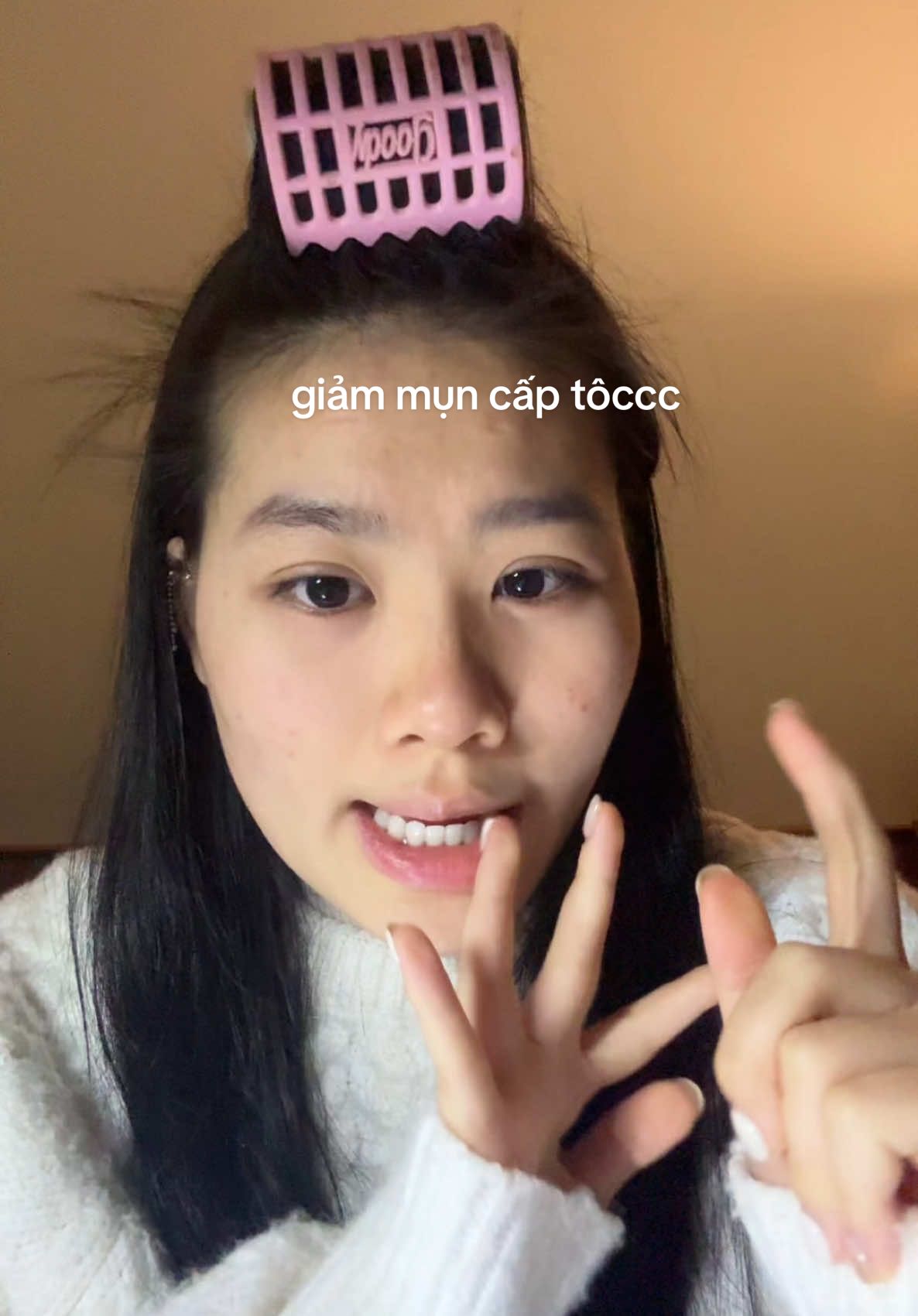 cách mình giảm mụn cấp tốcc #viral 