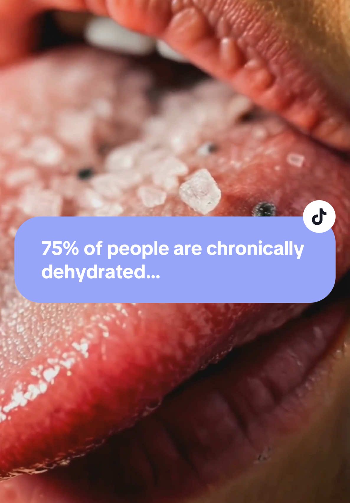 Study show that 75% of people are chronically dehydrated. This could be because most electrolyte products rely on synthetic minerals or too much sugar. ##nosugar##celticsalt##supplements##tiktokshop##massfollowing##tiktokmademebuyit