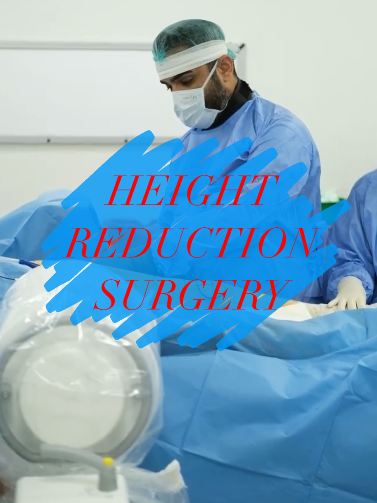 We have successfully completed our seventh aesthetic height reduction surgery, further strengthening our experience in this field. Our Algerian patient underwent a successful operation, with 5 cm shortened from the upper leg area. Height Before Surgery: 176 cm Height After Surgery: 171 cm #HeightReduction #HeightIncrease #HeightReductionSurgery #LimbLengtheningSurgery #Thigh #SaudiArabia #Morocco #Lebanon #Kuwait #Arabic #Turkey #Reduction #Height #Istanbul #Japan #USA