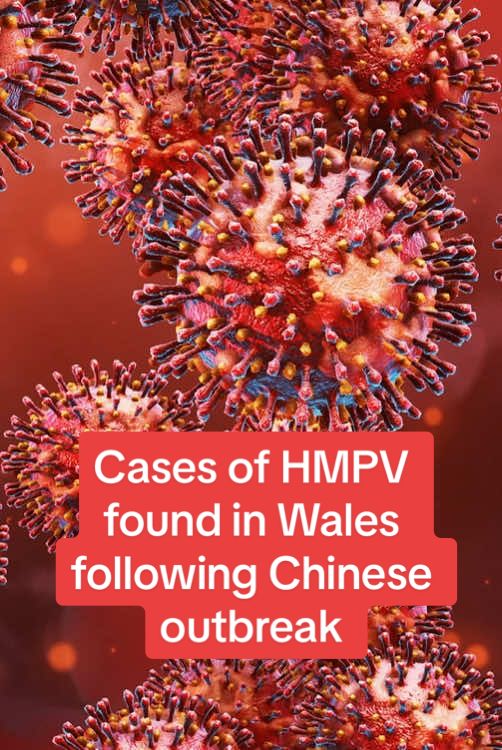 Cases of HMPV found in Wales following Chinese outbreak