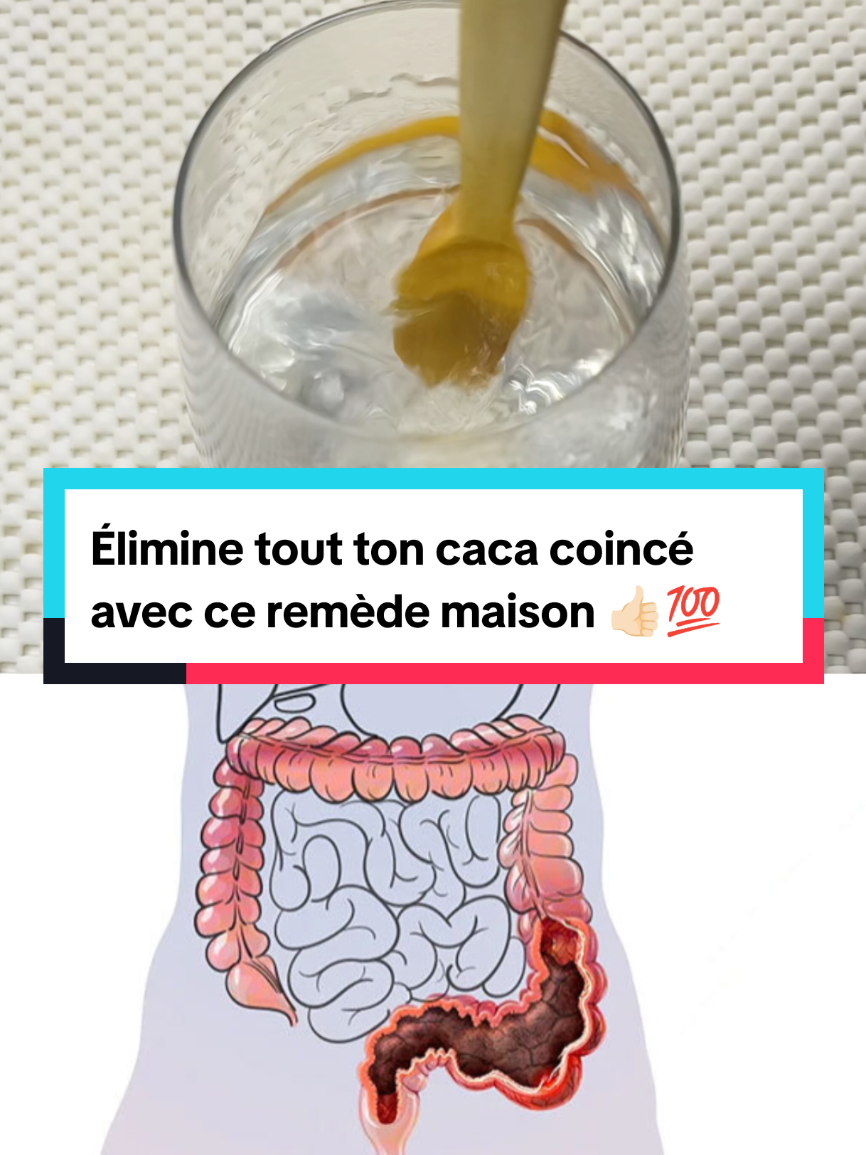 Élimine tout ton caca coincé avec  ce remède maison  #constipation #remedenaturel #recettefacile #soisnaturel #france🇫🇷 #livefest2024 @SoisNaturel @SoisNaturel @SoisNaturel 