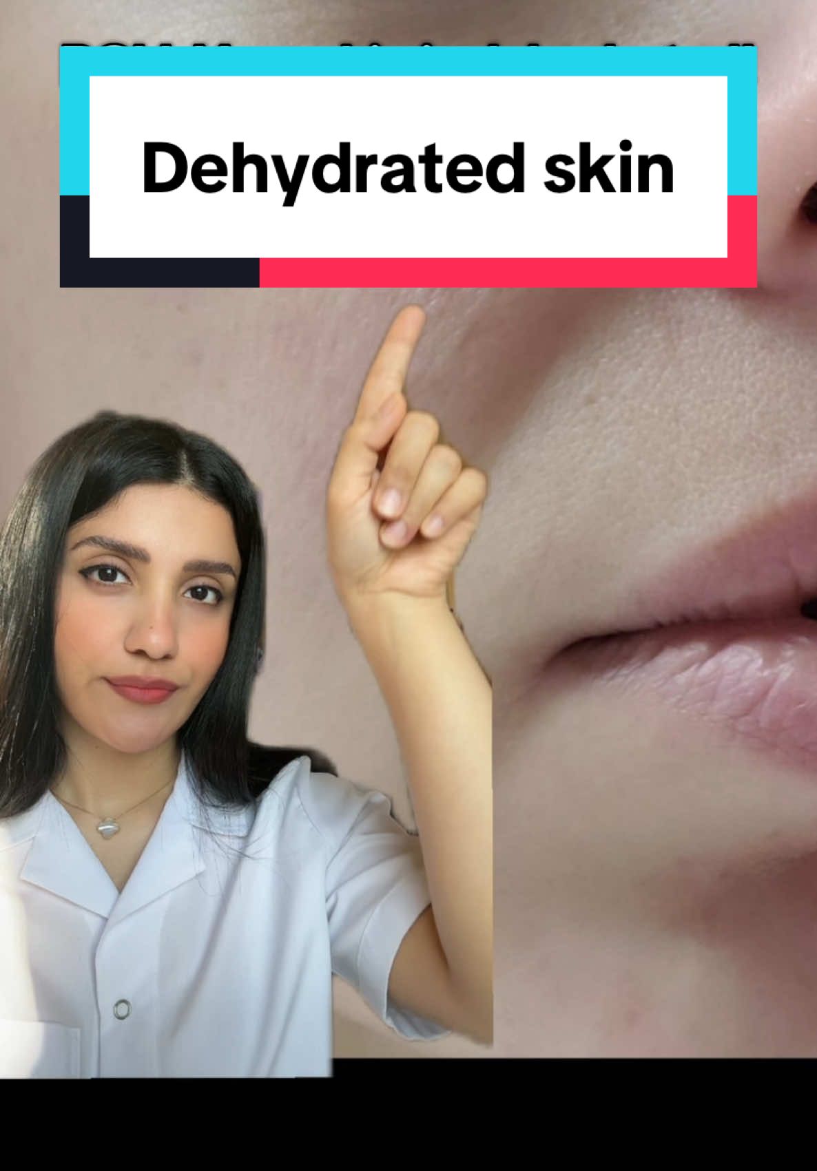 Hyaluronic acid hydrates the skin by attracting and binding water molecules, holding up to 1,000 times its weight in moisture. It locks in hydration, plumps the skin, and strengthens the skin’s barrier to prevent water loss, leaving it smooth and healthy. #dehydratedskin #dryskin #skincare 