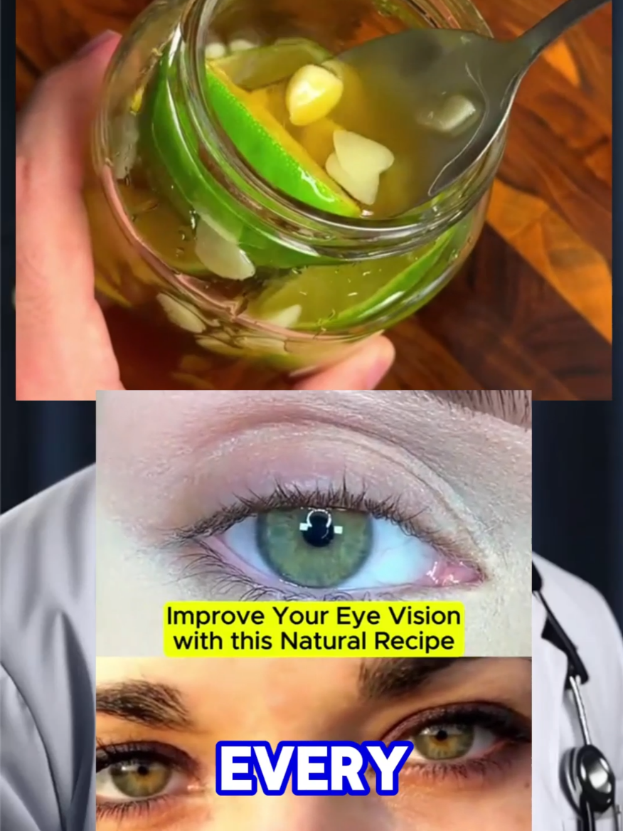 Say goodbye to blurry vision and restore your eyesight with this powerful natural recipe. #eyestrain #eye #sight #vision #eyehealth #eyesight  Just one spoonful every morning will help keep your eyes healthy naturally. #recipes #Recipe #remedy #naturalremedies #naturalrecipe 