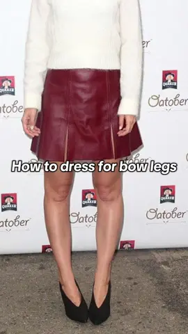 Bow legged outfit ideas - Outfit inspo for bow legged girls - Bow legged walk tips - Bow legged girls - Bow leg model - Bow legged outfit ideas - Outfit inspiration for bow legged girls - Bow legged walk tips - Bow legged girls - Bow leg model