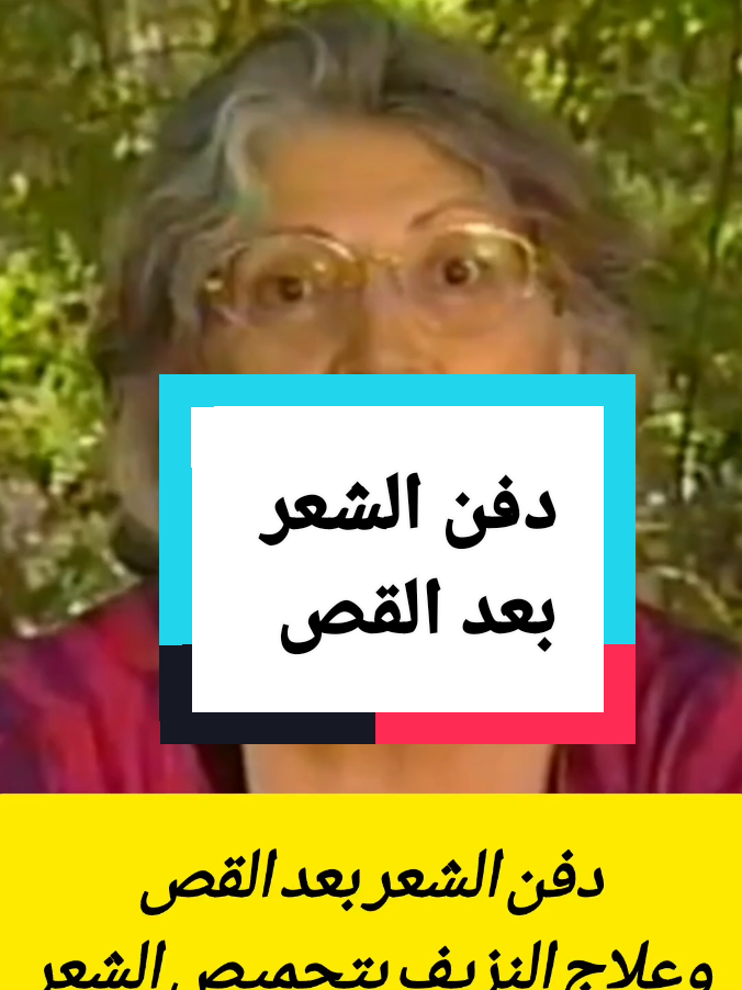 تحميص الشعر لعلاج النزيف ودفن الشعر بعد القص تاريخ الفيديو 1989 #مريم_نور #ديتوكس #الشعر #كثافة_الشعر #الشعر_الصحى 