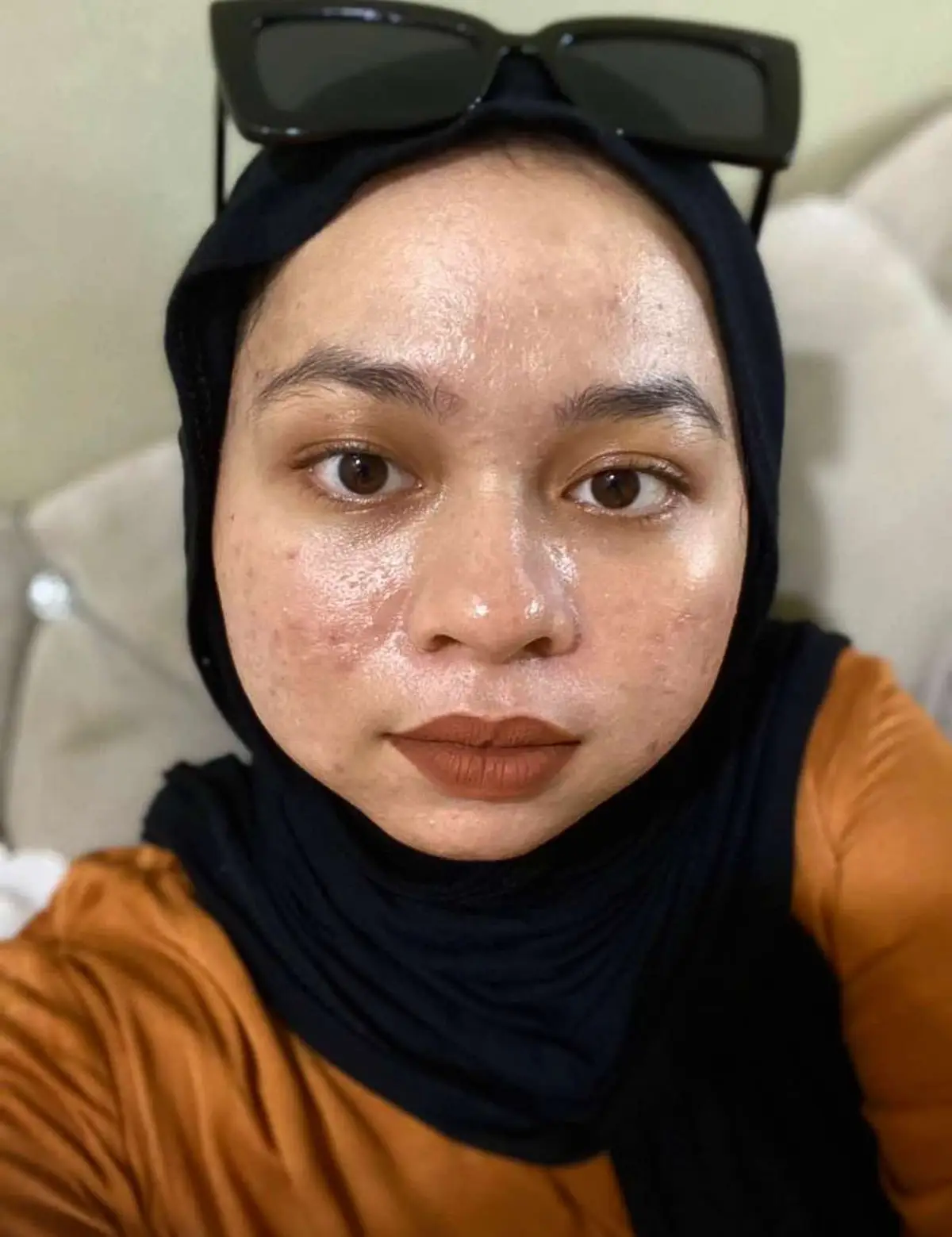 #shakleemalaysia #esp #vitaminc #organicsupplements #glowingskin #putihgebu #kulitcerah #tips #putihbersihglowing #GlowUp #gebugebas #clearskin #bebasjerawat #fyp #fypシ゚ #top #fypviral #soundviral #hellotiktok 