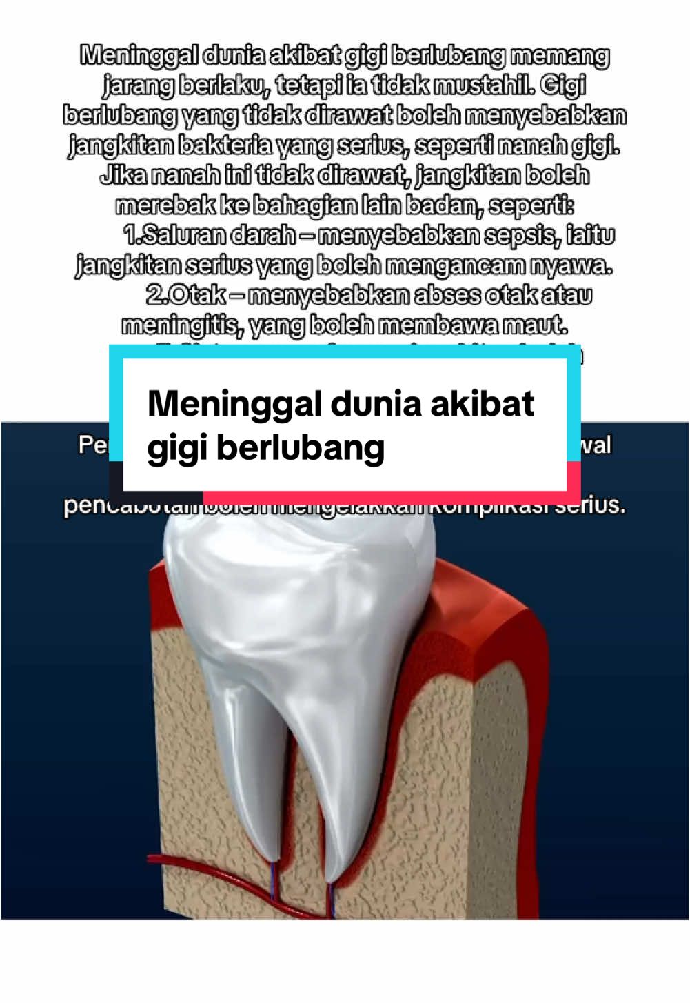 Jangan ambil mudah jika gigi anda berlubang! 