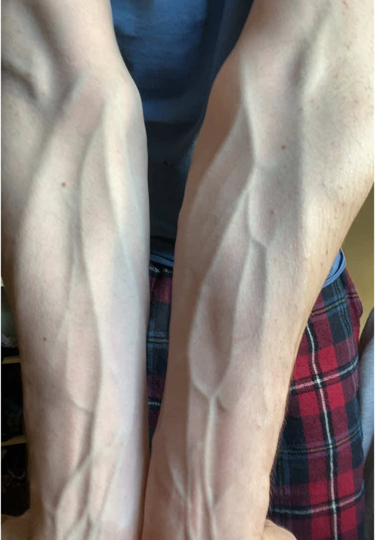 Like veins?😳 #veinyhands #vascular #armveins #hands #fyp #vein #veins #veiny 