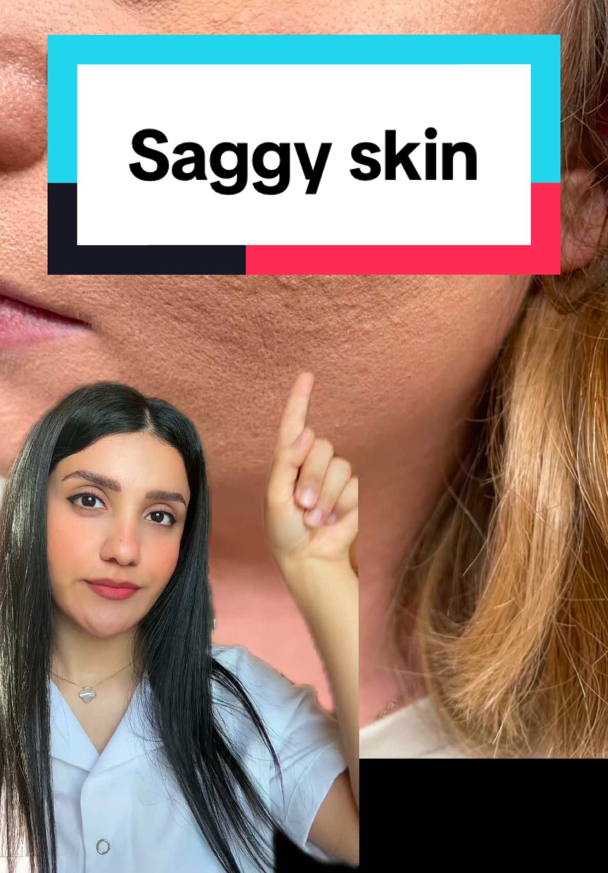 Retinol helps with saggy skin by boosting collagen, improving elasticity, and enhancing cell turnover. Use it 2-3 times a week at night, starting with a low concentration. Always follow with sunscreen during the day to protect your skin. #saggyskin #saggingskin #antiaging #aging 