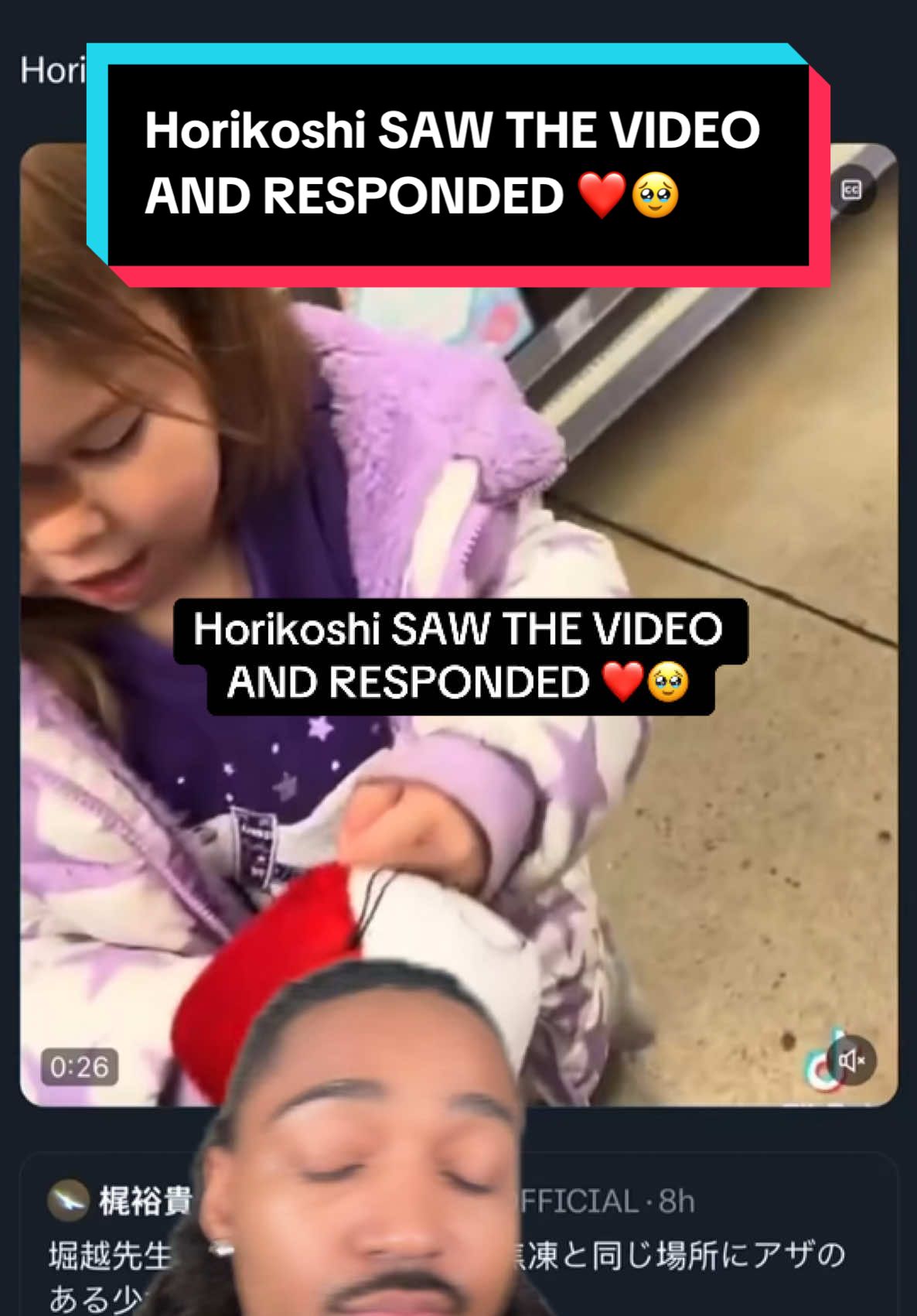 Horikoshi saw the video of the girl with the birthmark like Shoto Todoroki & his response was PERFECT ❤️ #myheroacademia #horikoshi #shototodoroki  