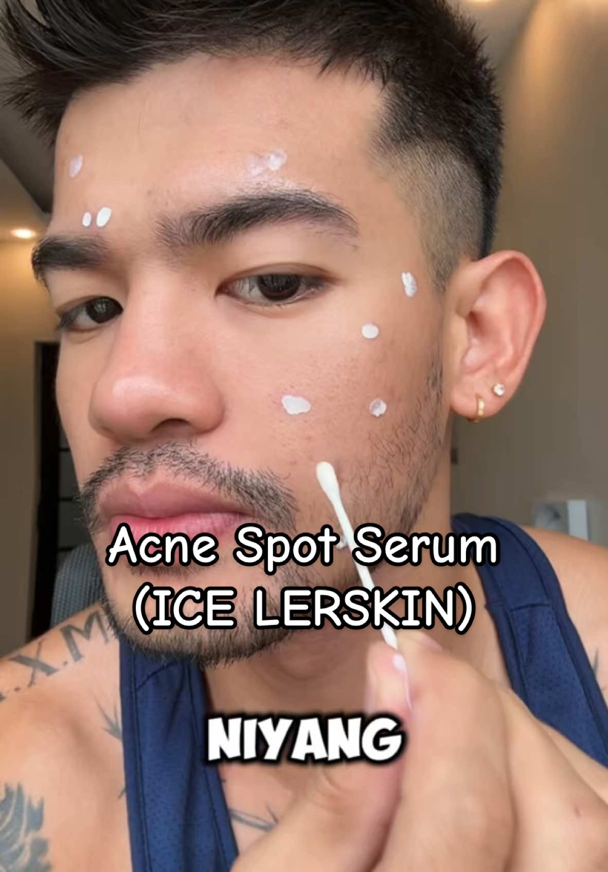 Kung nag be breakout ka, sign na to para mag checkout! #icelerskin #icelerskinph #acnetreatment #skincare #scar #acne 