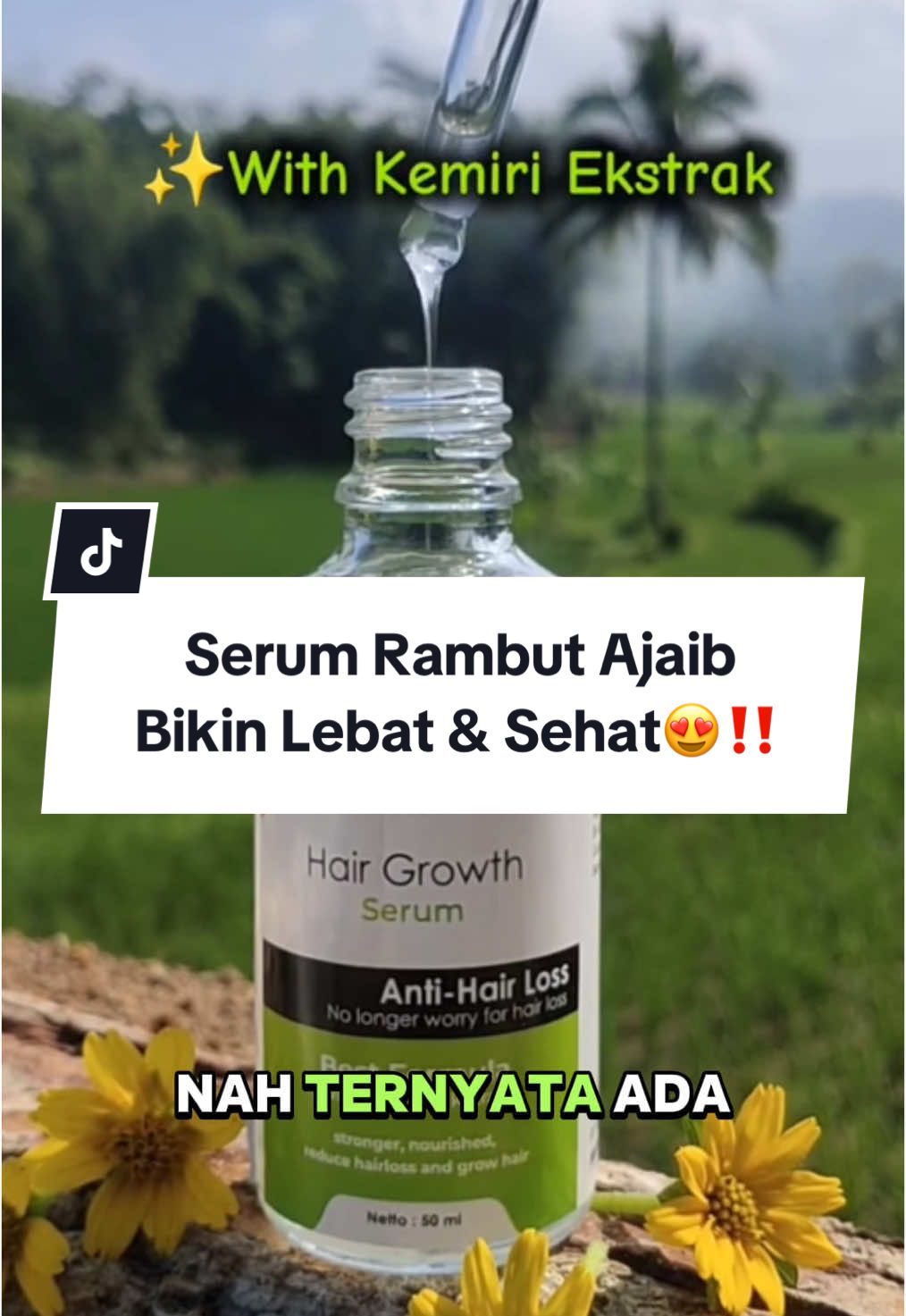 HAIR GROWTH SERUM bagus banget buat bantu ngurangin kerontokan & mempercepat pertumbuhan rambut.Langsung aja klik di keranjang kuning 😍 ✨#PromoGuncang11 #serumrambutviral #serum #myiwe #rambutrontok #myiwe #myiwehairgrowthserum #rambutrontok #serumrambutrontok #serumviral #viral #fyp #racuntiktok #belilokal #belilokaltiktok 