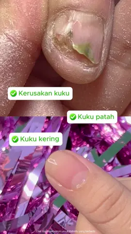 💅 Dapatkan kuku yang sempurna dengan kuku cair ini! ✨ Tahan lama dan cepat kering! #NailCare #PerfectNails #BeautyEssentials #RtopR #C254