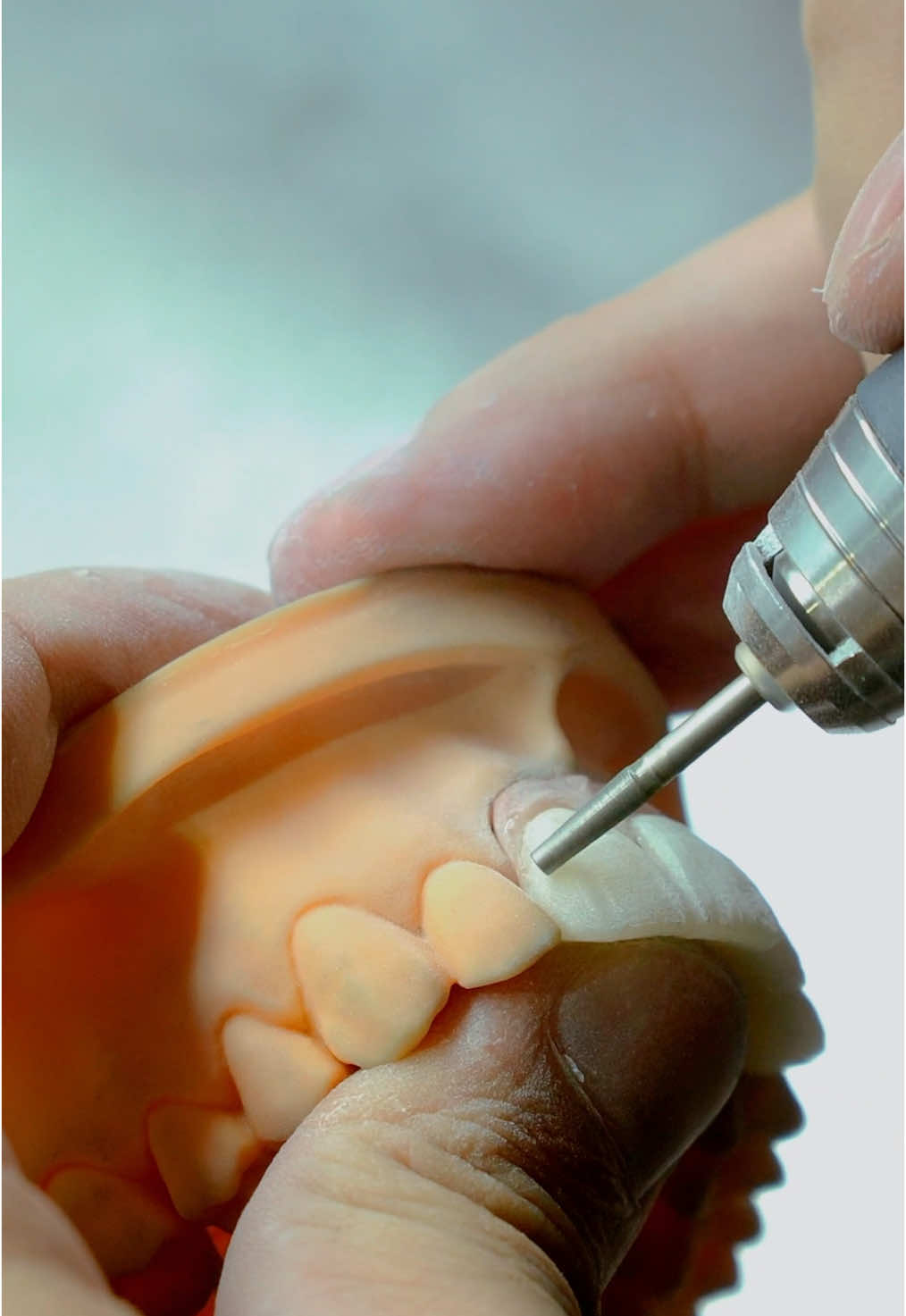 Đây là chúng tôi tạo ra nụ cười hoàn hảo 🥰🥰🥰 #RangSu #LaboHienDai #ThamMy #CongNgheCao #NhaKhoa #cayghepimplant #labonhakhoa #chamsocrangmieng #phuchinhrang #medi #medilab ##Veneers #CosmeticDentistry #FullMouthReconstruction #SmileMakeover #ToothContouring #DentalTips #DentalTikTok #TeethWhitening #ImplantDentistry #digitaldentistry #medi #medilab 