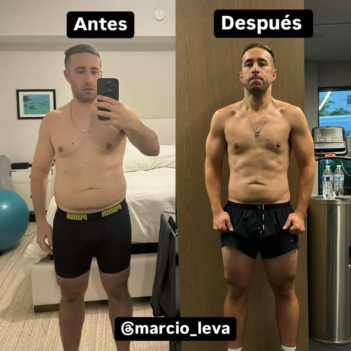 Michael es la prueba de que cualquier persona puede transformar su cuerpo y su vida con los pasos correctos. Cuando comenzamos, él tenía dudas, como muchos. Pero en lugar de dejar que esas dudas lo frenaran, decidió confiar en el proceso y en sí mismo. Lo que hicimos no fue magia, fue consistencia: un leve déficit calórico, una dieta alta en proteína, entrenamientos con pesas y un poco de cardio. No hubo sacrificios extremos, solo pequeños cambios sostenibles, como controlar sus macros, reducir el alcohol y reemplazar hábitos negativos por positivos. Hoy, Michael no solo luce increíble, sino que se siente más fuerte, más seguro y más saludable que nunca. Si tienes dudas sobre si tú también puedes hacerlo, déjame decirte algo: puedes. El primer paso es comprometerte contigo mismo. Si estás listo para empezar, yo estoy aquí para guiarte. ¿Qué estás esperando?