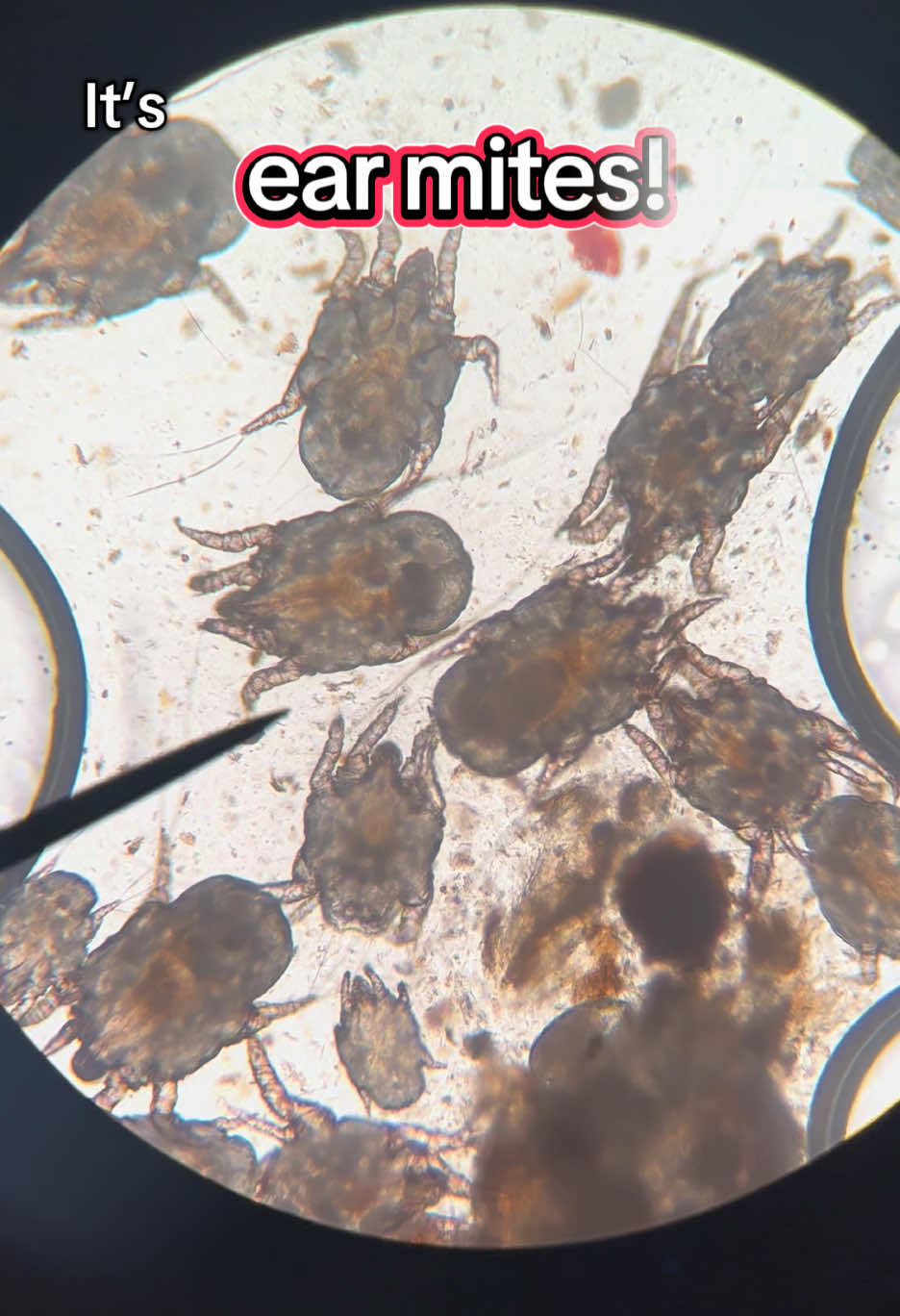 Take a look under the microscope with us at some ear mites! If you notice your pet scratching their ears, shaking their head and having lots of dark gunky discharge, ear mites are something we may test for. #vettok #vet #vetmed #earmites #vetclinic