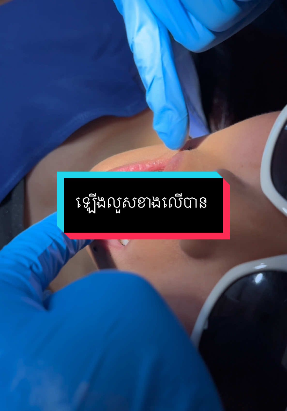 Check up ដូរកៅស៊ូ #គ្លីនិកធ្មេញគ្រេតស្មាល #greatsmiledentalclinic #teamធ្មេញដែក #ពត់ធ្មេញ #ព្យាបាលធ្មេញ #ធ្មេញដែក #braces #fyp 