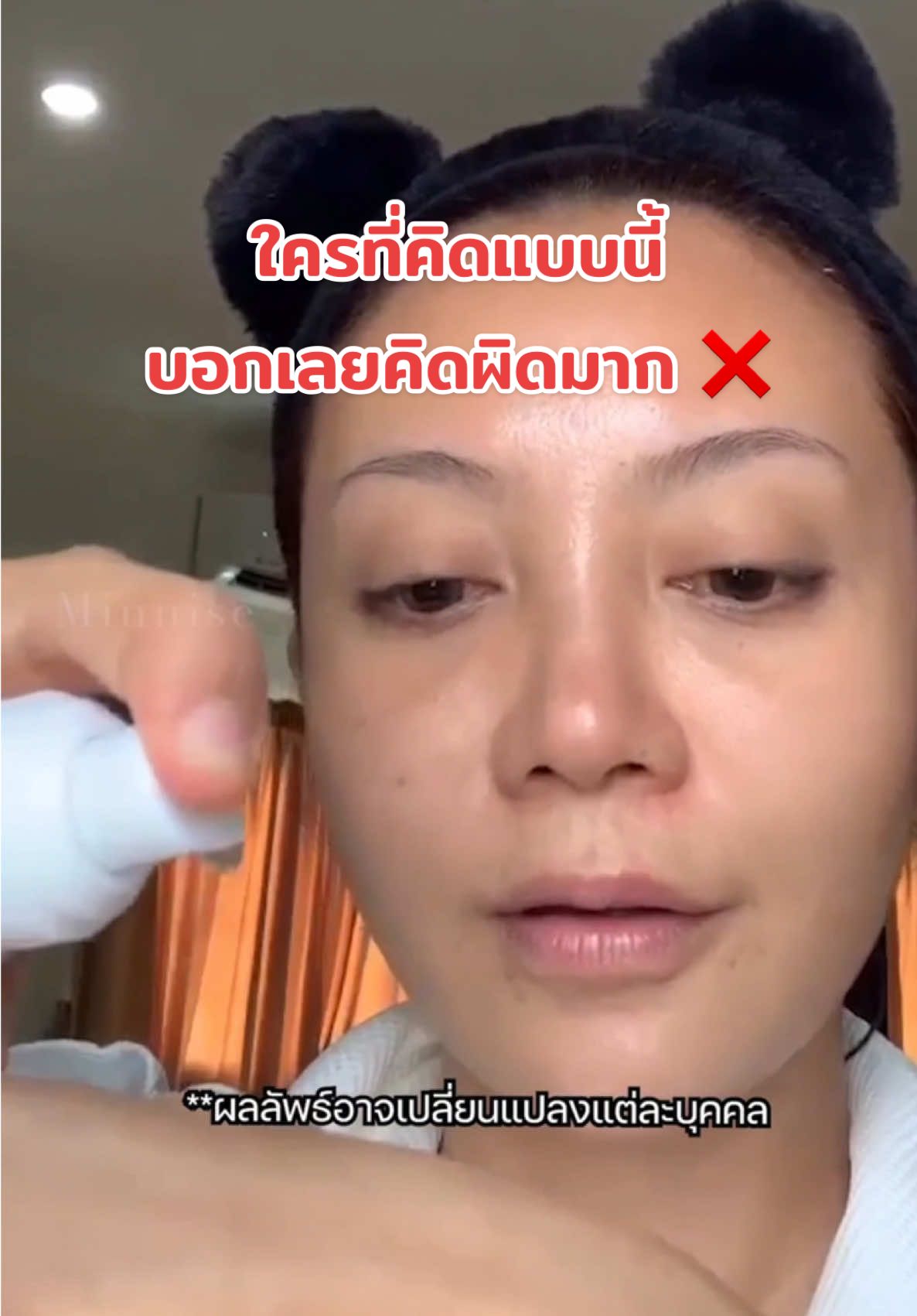 คิดแบบนี้อยู่ ควรคิดใหม่ด่วน‼️ #minnise #ฝ้า #ป้ายยาtiktok #tiktokรีวิว #tiktok #อาร์บูติน #มินิเซ่อาร์บูติน #หน้าติดสาร 