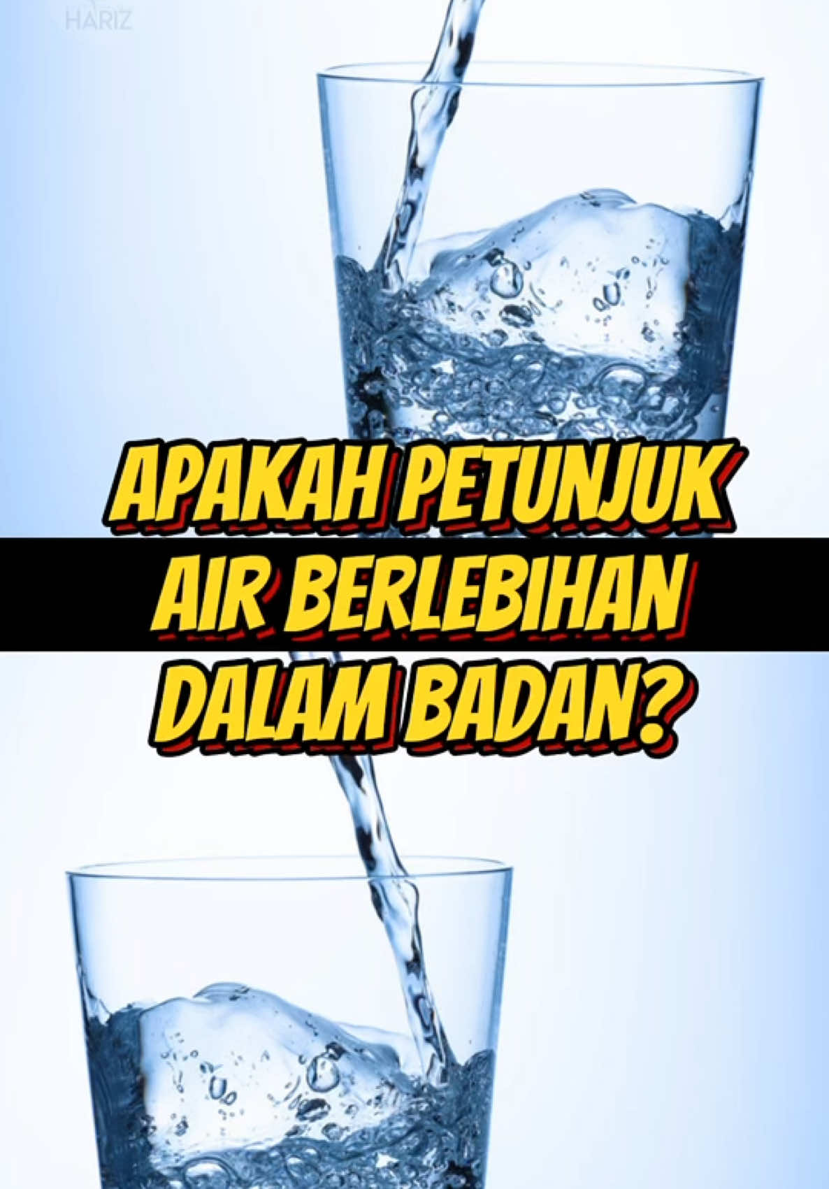 APAKAH PETUNJUK AIR BERLEBIHAN DALAM BADAN BAGI PESAKIT BUAH PINGGANG??💧 . 1. Bengkak kaki (edema) 2. Peningkatan berat badan dalam masa yang singkat. 3. Sesak nafas/kesukaran bernafas 4. Pengumpulan cecair pada rongga perut (ascites) . Untuk pesakit baru atau lama. Jemput datang ke Pusat Dialisis Hariz untuk dapatkan rawatan and consultation 😁 Feel free to set your appointment atau walk-in pun boleh je 🤩🤩 Dialysis Centre in Johor Bahru 🦷✨ . Visit our website to know more at www.dialisishariz.com . Kami buka dari 7 pagi sehingga 5 petang. Boleh buat appoinment dengan kami 🤩 Waktu Operasi : Ahad - Jumaat (7am-5pm) Tutup : Sabtu . ☎️ 07 - 355 8040 ☎️ 011 - 1129 4676 www.wasap.my/601111294676 . Pusat Dialisis Hariz NO 86, 86-01 & 86-02, JALAN ADDA 7, TAMAN ADDA, 81100 JOHOR BAHRU . #pusatdialisis #cucibuahpinggang #dialisis #dialysiscentre #centre #johorbahru #jdt #jb #fyp #fypage #foryou #fyppppppppppppppppppppppp #foryoupage 