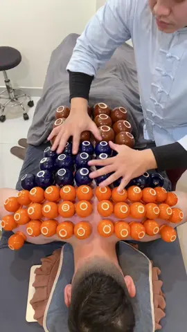 [ASMR] He said he enjoys the sound when I remove each cup. #asmr #cuppingtherapy #xuhuong #trilieuhaiphong #massage 