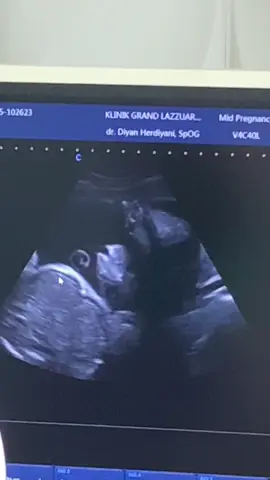 Mashalloh tabarokalloh 🤲🏼🥰 #pregnant #bumiltm3 #fy #trendingvideo #mashaallahtabarakallah #allohummasollialaasayidinamuhammad #allohummabarik 