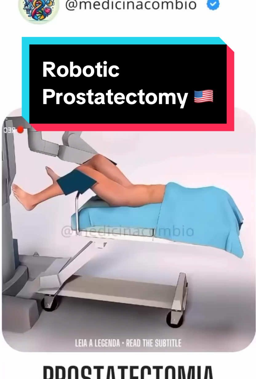 #roboticsurgery #prostatectomia #prostatectomiarobotica #prostata #prostatectomy #prostatectomía #medstudent #medicina #medicine #estudiantedemedicina 