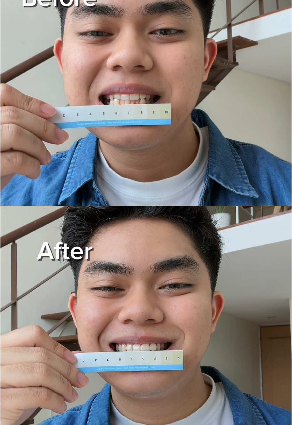 Pernah gk? Wkwkwkwk #fyp #dentix #teethwhitening  @Dentix.id 