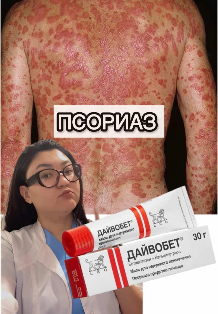 А какие у вас проблемы? #прыщик #прыщилечение #ретинол #расширенныепоры #проблемнаякожа #пигментация #пигментныепятна #прыщ #псориазлечение #экзема #дерматит 