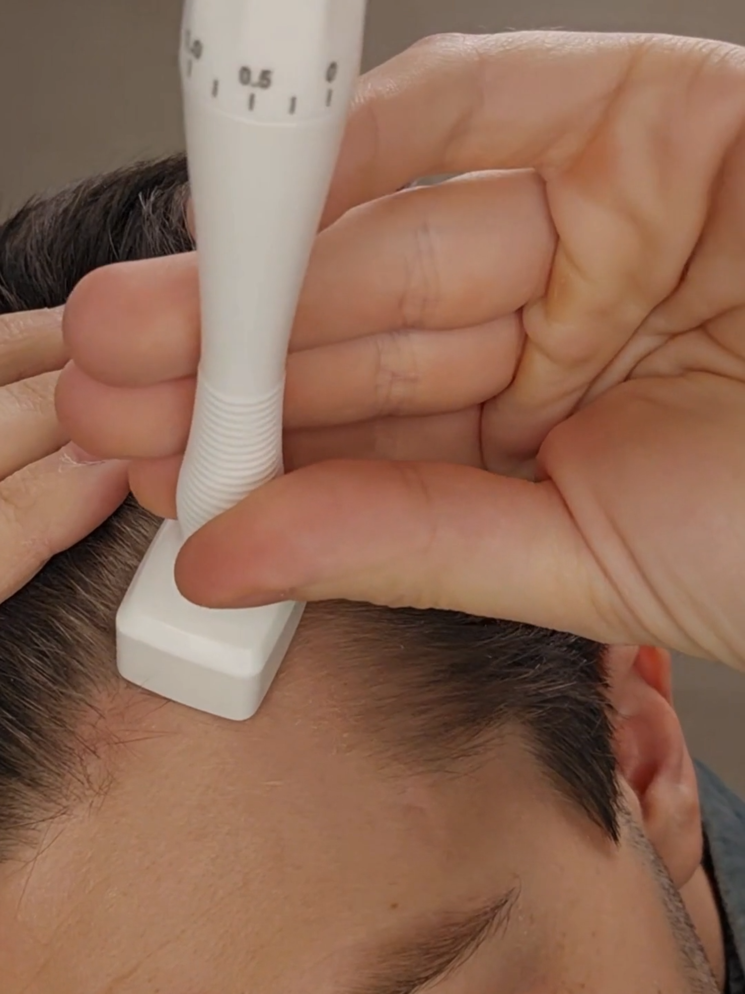 How to use the Derma Stamp for hair loss #hairloss, #hairregrowth, #dermaroller, #microneedling, #microneedlingdevices, #minoxidil, #finasteride, #rosemaryoil, #haircare, #hairgrowthtips, #hairthinning, #scalpcare, #healthyhair, #hairrestoration, #hairtransplant, #alopecia, #hairgrowthjourney, #hairline, #scalpmicroneedling, #biotin, #hairgoals, #hairtreatment, #hairlinegrowth, #propecia, #rogaine, #mielle, #regrowhair, #dermarollertreatment, #hairfallsolution, #baldness, #menshaircare, #thickerhair, #hairgrowthproducts, #hairgrowthstimulation, #microneedlingforhair, #scalptherapy, #hairrestorationtreatment, #follicleboost, #menshair, #haircareformen, #microneedlingforhairgrowth, #hairfallprevention, #hairtreatmentforhairloss, #hairregrowthproducts, #hairshampoo, #menhairloss, #topicalhairloss, #propeciatreatment, #prptherapy, #hairgrowthserum, #dermafix, #dermarollerforhair, #hairthinningtreatment, #follicleresearch, #hairsupport, #antiaginghaircare, #hairscalpserum, #naturalhairgrowth, #scalpprotection, #antiaginghair, #healthyhairgrowth, #advancedhaircare, #microneedlingforhairloss, #besthairgrowthproducts, #hairthinningremedies, #thickhair, #naturalhaircare, #folliclehealth, #innovativehaircare, #fastgrowthhair, #hairtransformation, #hairrestorationjourney, #hairsolutions, #selfcareformen, #haircareproducts, #haircareformen, #topicaltreatments, #healthyhairgrowth, #hairgrowthoil, #microdermabrasion, #hairtreatmentsforhairloss, #scalptherapy, #provenhairtreatments, #hairgrowthchallenge, #hairtransplantresults, #microneedlingdevice, #roguine, #dhtblocker, #healthyscalp, #hairlossprevention, #minoxidil5, #hairgrowthsupplements #algarrido #folliroll #follirolldermaroller