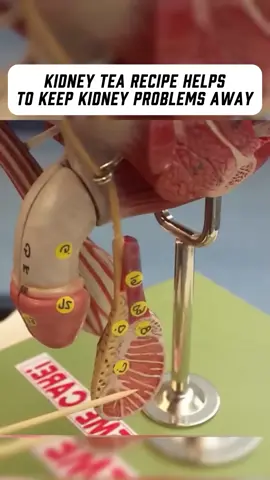 Kidney tea recipe keeps kidney problems away #tiktokshop #tiktokfinds #kidney #kidneycare #health #tea 