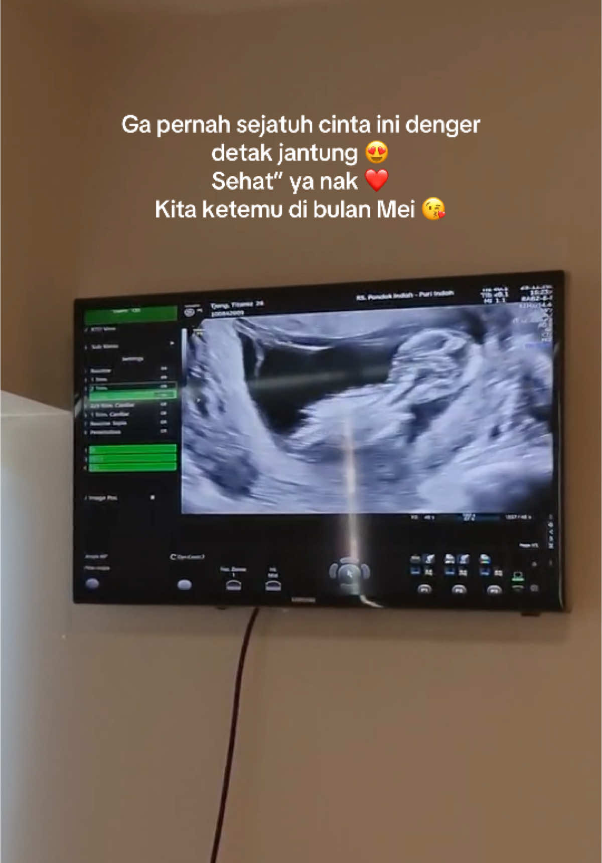 Akhirnya bisa pake sound ini ☺️Sehat” anakku ❤️🥰 #hamil #ibuhamil #pregnant #pregnancyjourney #fyp 