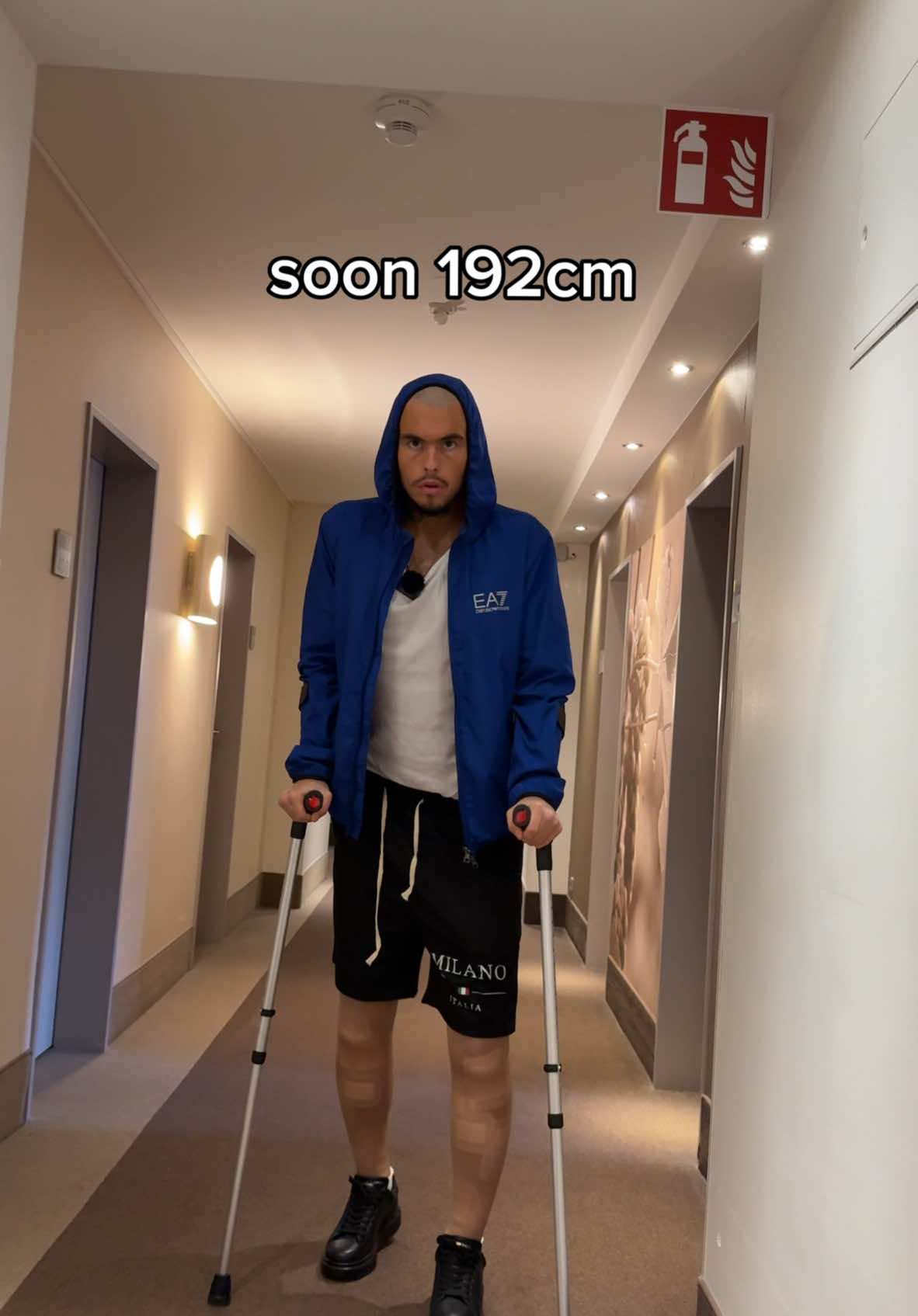 Ain‘t no mercy #limblengthening #heightproblems #heightsurgery #becometaller #growtaller #leglengthening #increaseheight #heightincrease #beforeandafter #tallmen #shortmen#beinverlängerung #körpergröße #fyp #viral 