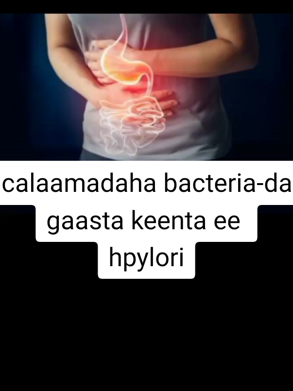 Bacteria-da xanuunka gaaska keenta iyo calaamadaheeda#cuntada #caafimaad #hpylori #hpyloriinfection #hpyloripositive 