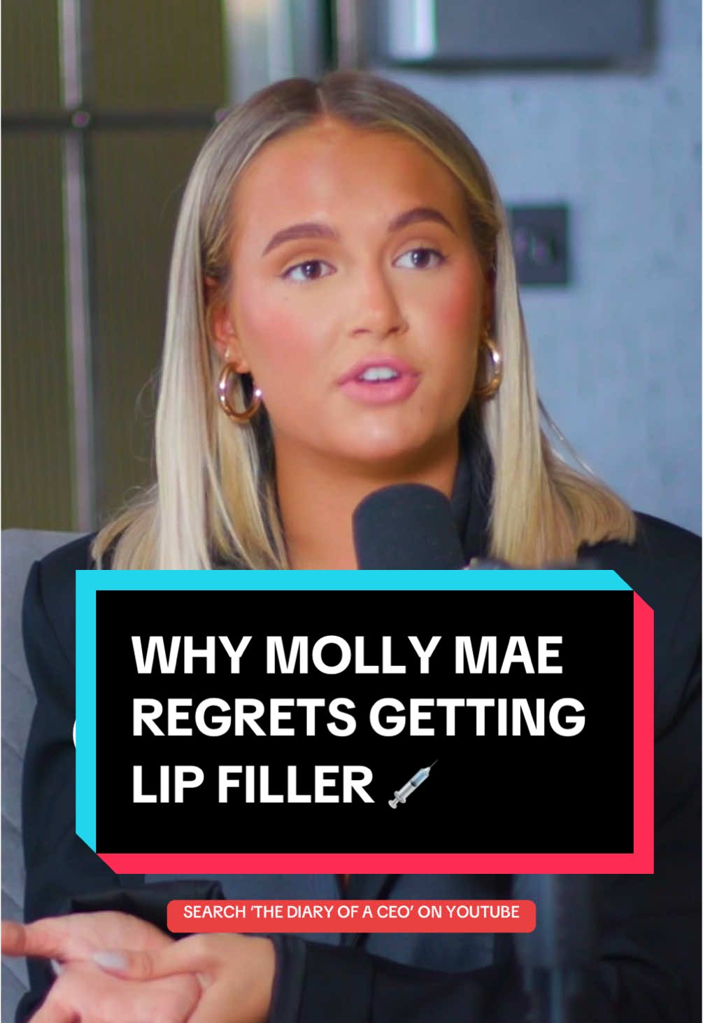 Search 'The Diary Of A CEO' on YouTube to watch the full episode. Molly Mae reveals why she regrets getting lip filler and why that picture trending on Twitter made her want to get it dissolved.  #mollymae #Lovelsland #lipfiller #lipfillerchallenge #jawfiller #plasticsurgery #botched  #loveislandallstars #amazonprime #molly #stevenbartlett #realitytv #filterbymollymae #tommyfury #diaryofaceo #podcasts #interview Behind it all Molly-Mae Love island Love island all stars Tommy fury Maebe Filter by molly mae Amazon prime 