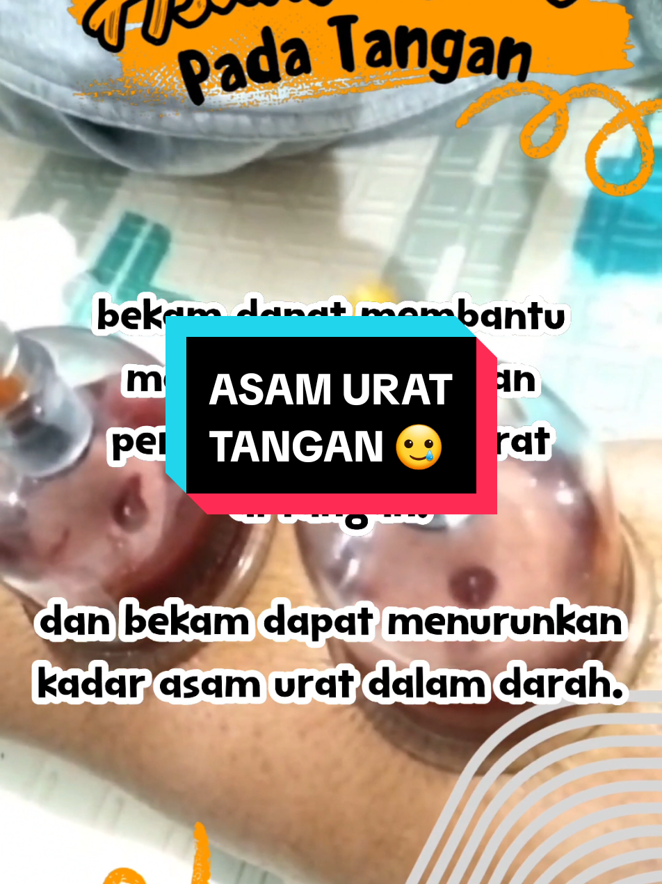 #jakarta #bandung #bekamsunnah #bekamangin #cuppingmassage #bekamdarah #cuppingtherapy #bekamdatangkerumah #hijamatherapy #darahkotor #bekampanggilan #hijamah #bekam #bekamsumedang #bekamjakarta #bekambandung #bekampria #bekamwanita #fyp #hijama 