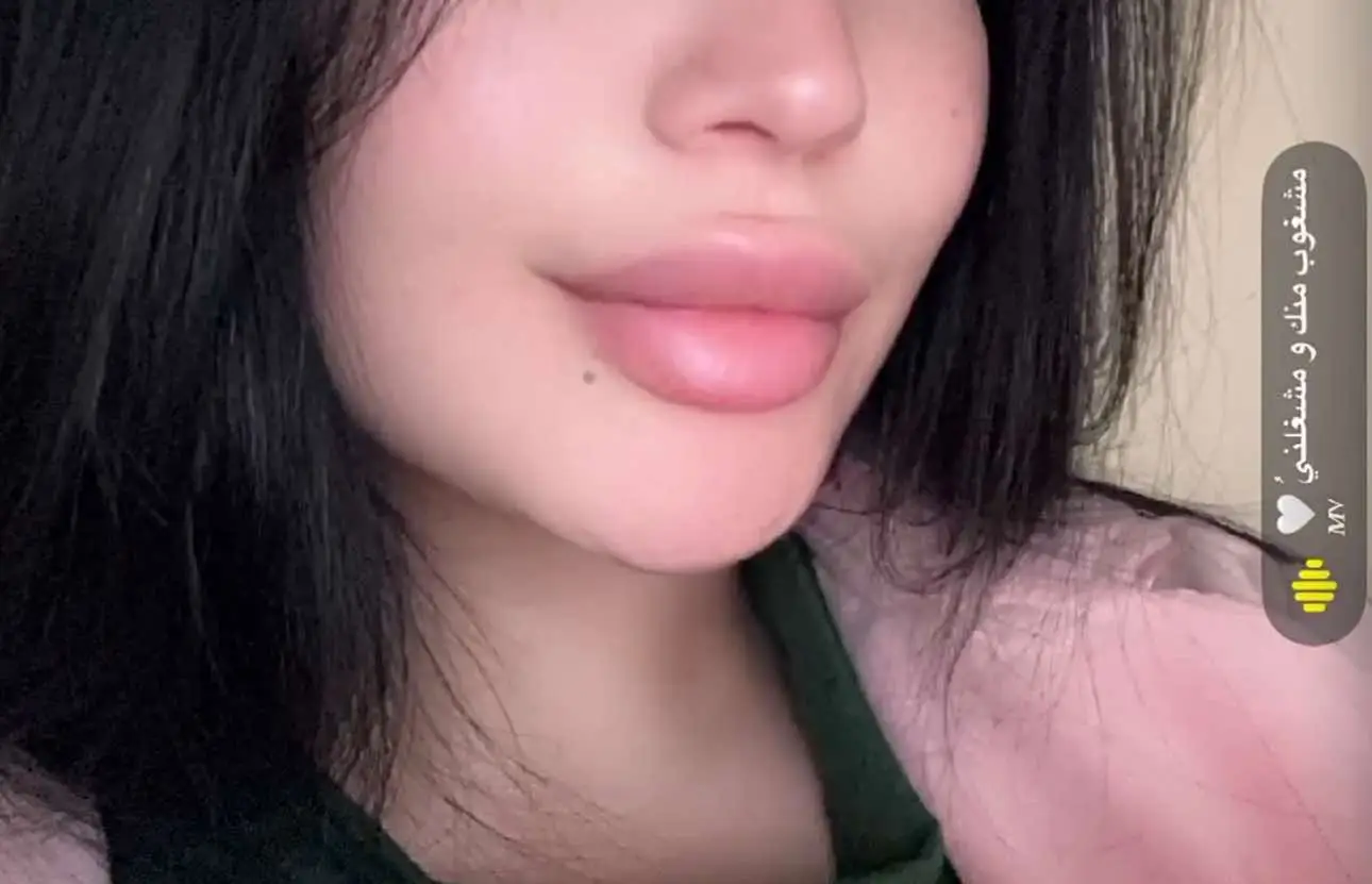 #fyp✨ 