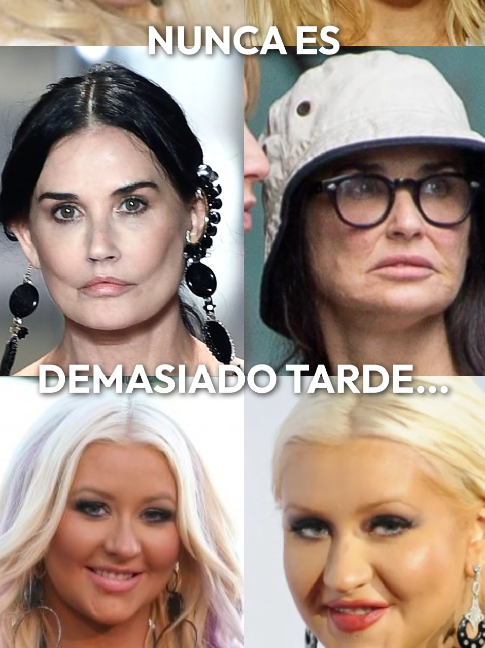 Ellas nos enseñaron que nunca es demasiado tarde para empezar a cuidarse ✨ #lindsaylohan #demimoore #cristinaguilera #fyp #morpheus #PDRN #dramarissacharaja #Morpheus8 #rejuvenecimientofacial #exosome #bioestimuladordecolageno #antesydespues #newface #greenscreen #arrugasfaciales  qué se hizo Lindsay Lohan? qué cirugía se hizo Lindsay Lohan? Cristina Aguilera now Demi Moore new face
