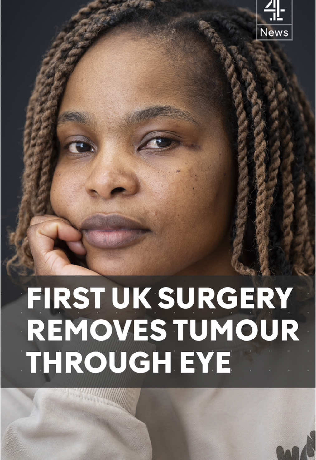 Doctors in the UK have performed the first operation to remove head cancer through a corner of an eye socket. A new non-invasive surgery called the endoscopic trans-orbital approach allows once-inoperable tumours to be removed in a three-hour surgery.   #braintumour #surgery #health #channel4news #c4news