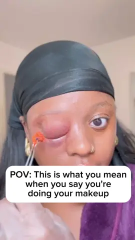 Still obsessed with this even though I rarely do hair punching super happy with the eyebrow 🥰 #fyp #foryou #sfx #sfxmakeup #mua #prostheticeye 