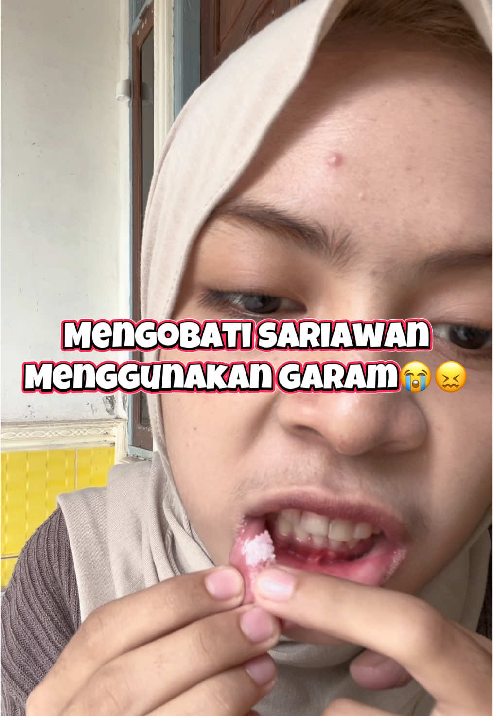 Tutorial menyiksa hidup. sariawan+garam😭😭😭😭😰 OMG😖😖😖😖 #sariawanmelandabibir #sariawanpakegarem #sariawan #tutorial #garam #fyp #fypシ #xybca #4u #4upage #4upageシ #foryou #foryoupage #xybc #tutorials #trendingvideo 